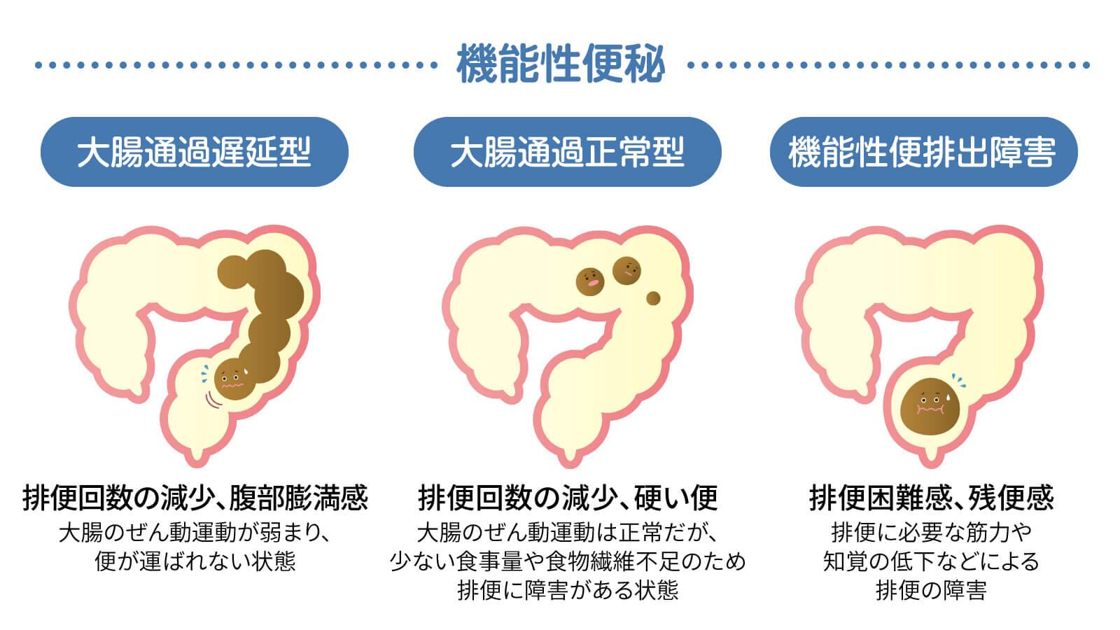 便秘の看護計画 アセスメントやケア方法、便秘の種類・メカニズム | ネスレ栄養ネット